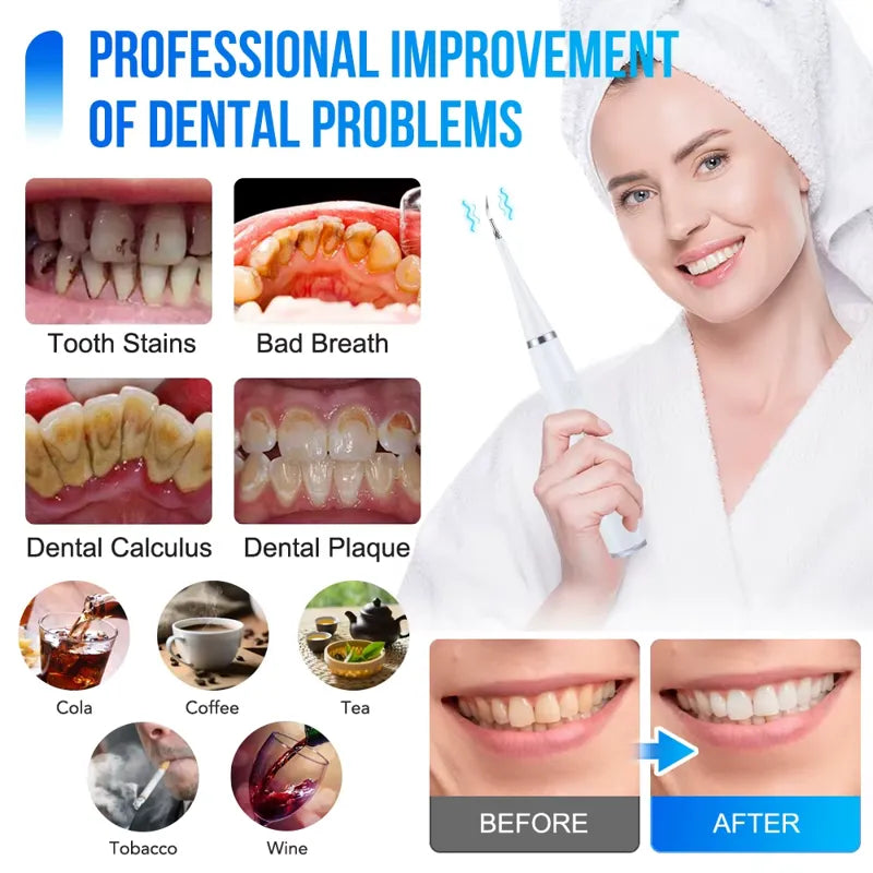 Revolutionize Your Oral Care with the 6-in-1 Ultrasonic Cleaning System: Electric Toothbrush & Tartar Remover Combo